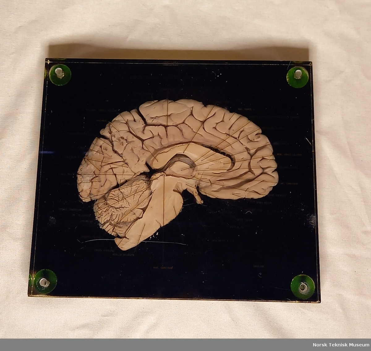 Tverrsnitt av hjerne i glasslignende materiale med påført tekst som viser til forskjellige hjernedelene med svart bakgrunn.
