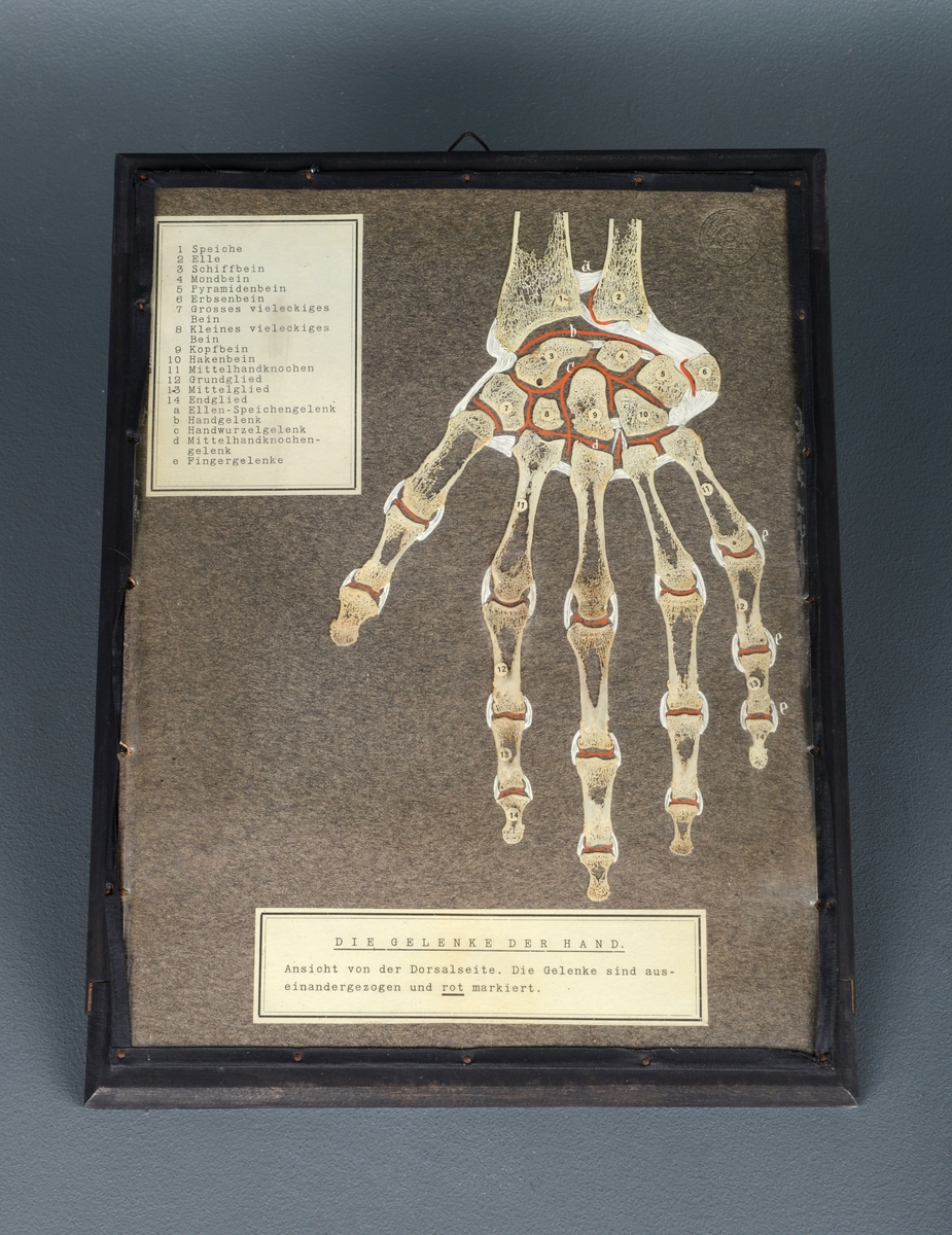 Anatomisk illustrasjon av baksiden av håndens ledd. Tysk undervisningsillustrasjon med nummerert liste over leddene i hånden. Illustrasjonen er på en plansje spikret til en ramme i tre og plast, med 20 små spiker. Delene av hånden er montert på papiret.