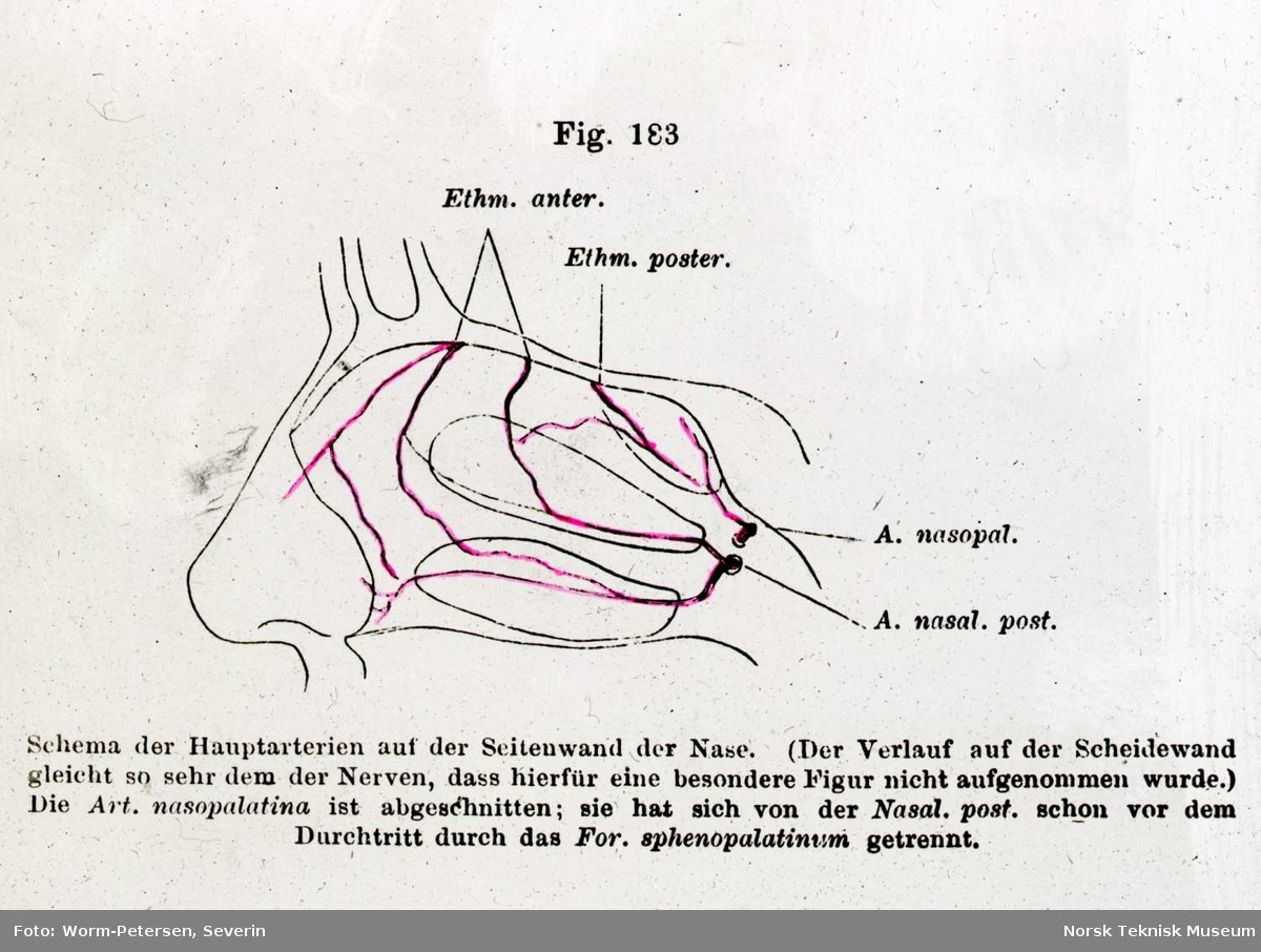 Kolorert anatomisk tegning av øyets anatomi. Avfotografert fra tysk illustrasjon.