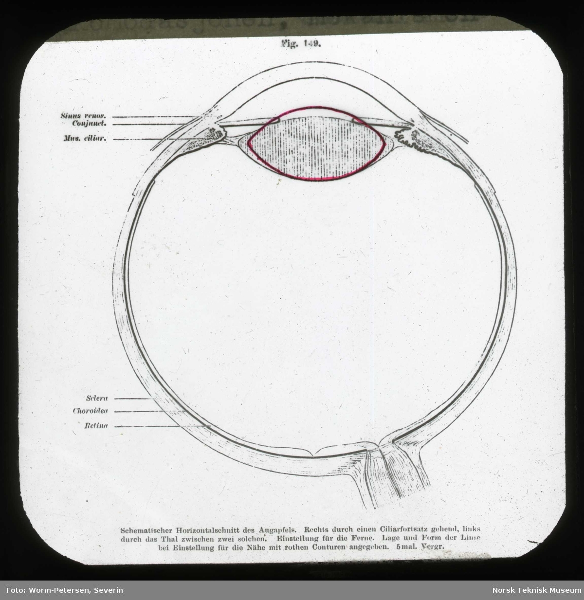 Anatomi; Øyet. Akkomodasjonen, mekanismen.