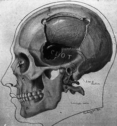 Dr. Magnus (Hjernen)